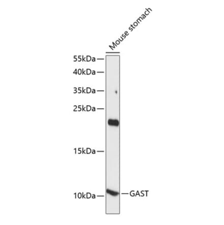 Western Blot - Anti-Gastrin Antibody (A88005) - Antibodies.com