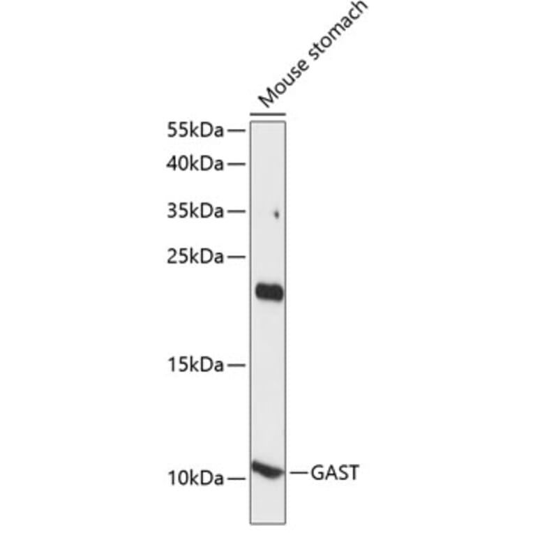 Western Blot - Anti-Gastrin Antibody (A88005) - Antibodies.com