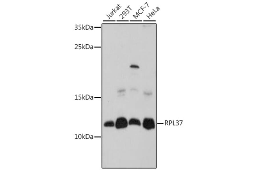 Western Blot - Anti-RPL37 Antibody (A88006) - Antibodies.com