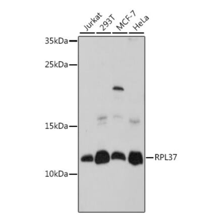 Western Blot - Anti-RPL37 Antibody (A88006) - Antibodies.com
