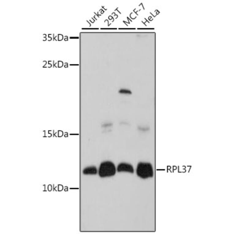 Western Blot - Anti-RPL37 Antibody (A88006) - Antibodies.com