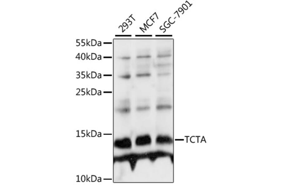 Western Blot - Anti-TCTA Antibody (A88007) - Antibodies.com