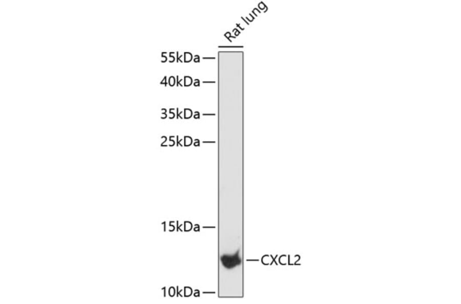 Western Blot - Anti-CXCL2 Antibody (A88008) - Antibodies.com