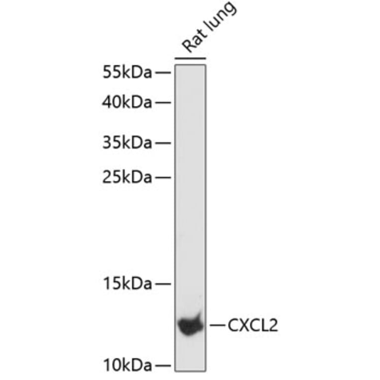 Western Blot - Anti-CXCL2 Antibody (A88008) - Antibodies.com