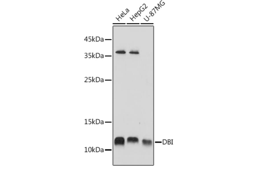 Western Blot - Anti-DBI Antibody (A88009) - Antibodies.com