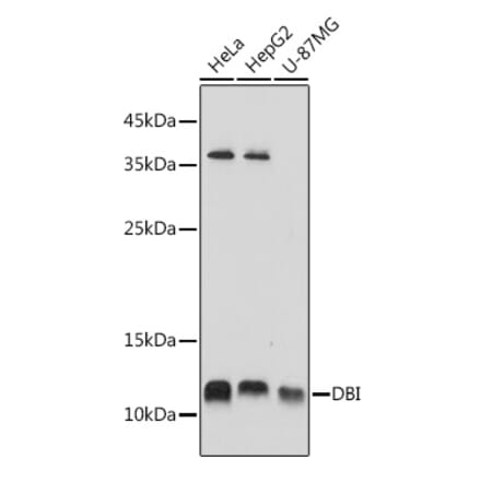 Western Blot - Anti-DBI Antibody (A88009) - Antibodies.com