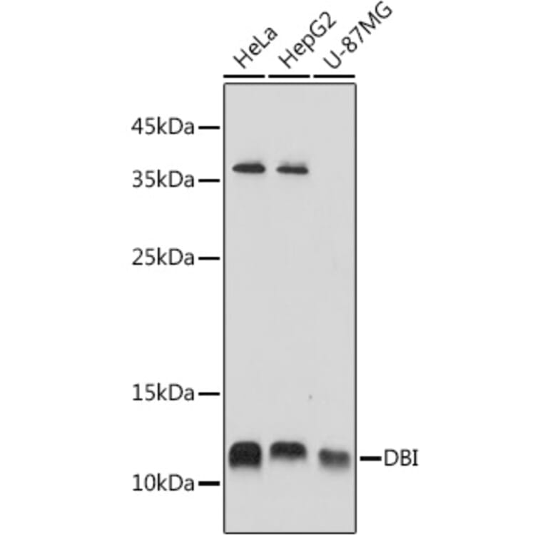 Western Blot - Anti-DBI Antibody (A88009) - Antibodies.com