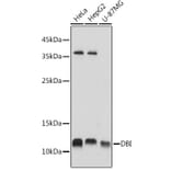 Western Blot - Anti-DBI Antibody (A88009) - Antibodies.com