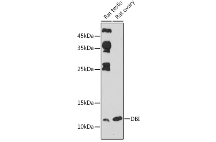 Western Blot - Anti-DBI Antibody (A88009) - Antibodies.com