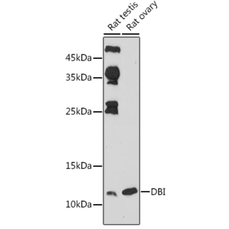 Western Blot - Anti-DBI Antibody (A88009) - Antibodies.com