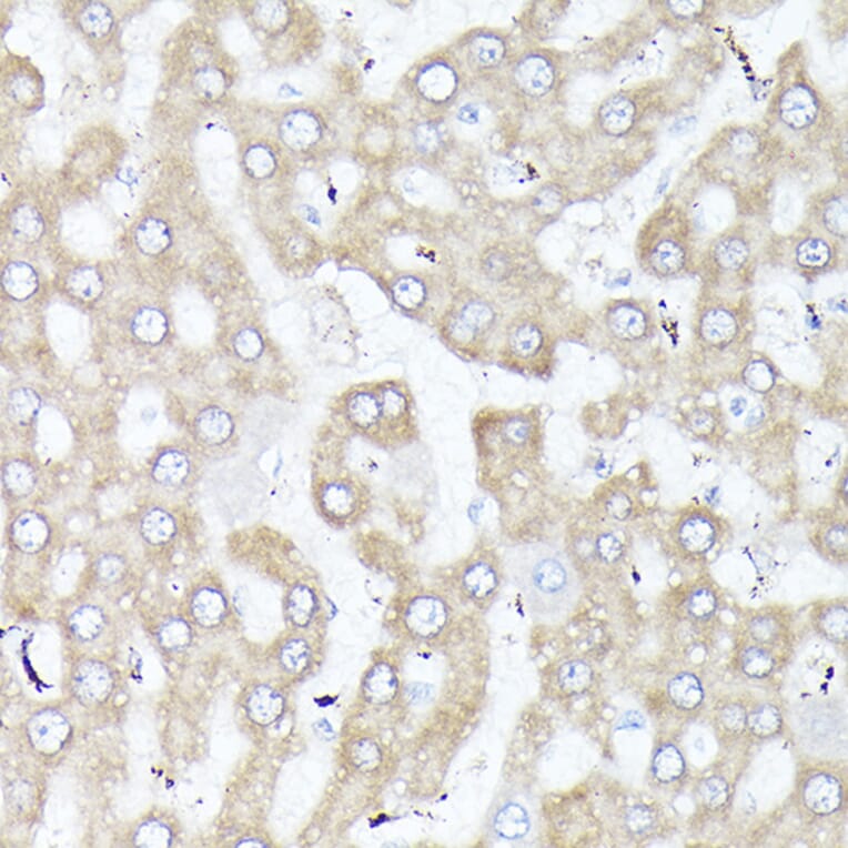 Immunohistochemistry - Anti-DBI Antibody (A88009) - Antibodies.com