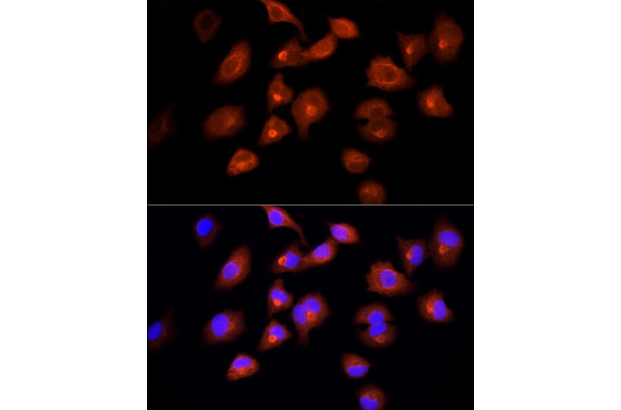 Immunofluorescence - Anti-DBI Antibody (A88009) - Antibodies.com