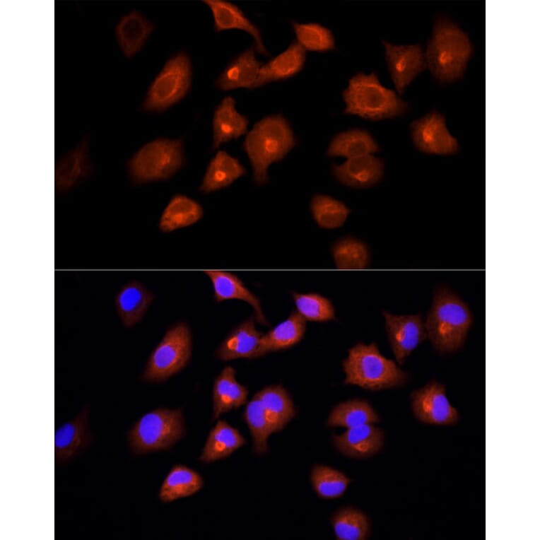 Immunofluorescence - Anti-DBI Antibody (A88009) - Antibodies.com