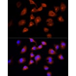 Immunofluorescence - Anti-DBI Antibody (A88009) - Antibodies.com