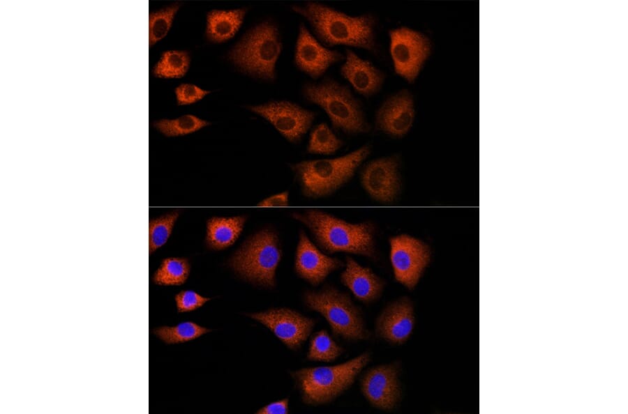 Immunofluorescence - Anti-DBI Antibody (A88009) - Antibodies.com
