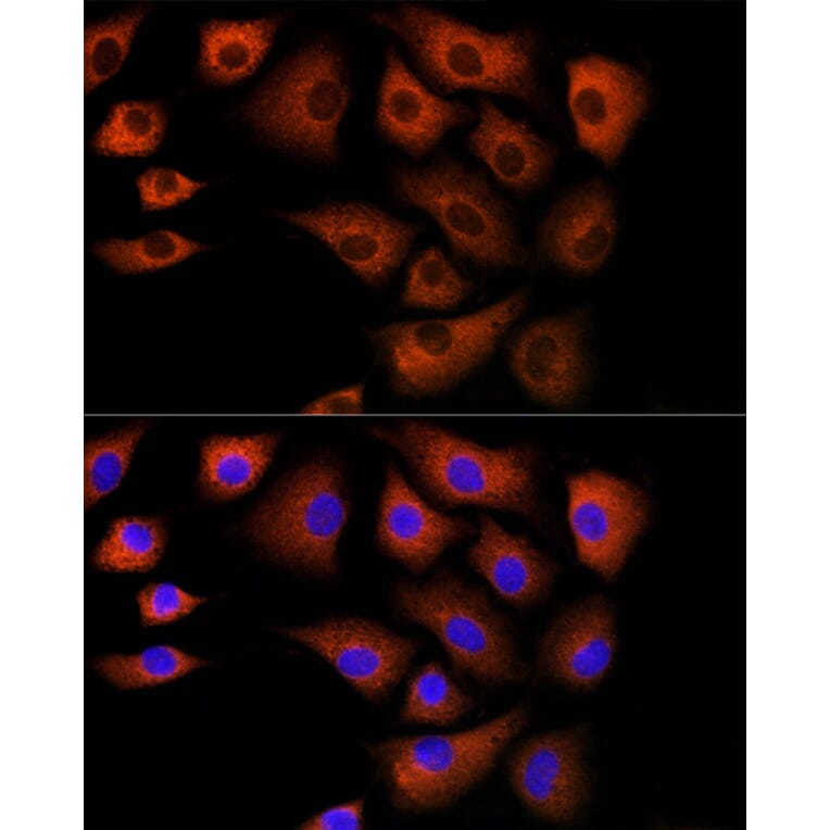 Immunofluorescence - Anti-DBI Antibody (A88009) - Antibodies.com