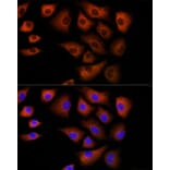 Immunofluorescence - Anti-DBI Antibody (A88009) - Antibodies.com