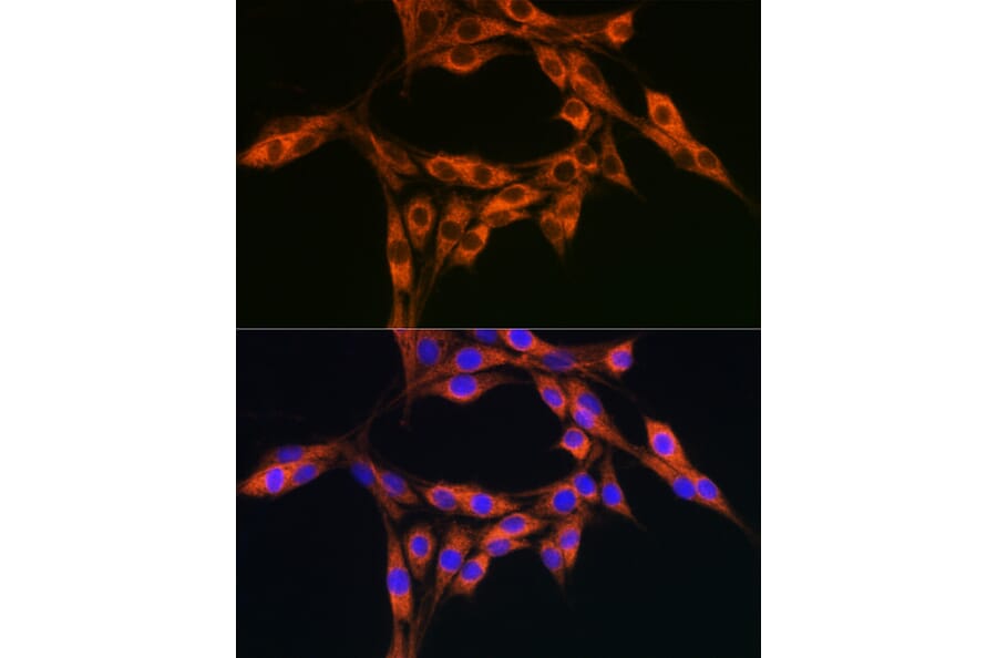 Immunofluorescence - Anti-DBI Antibody (A88009) - Antibodies.com
