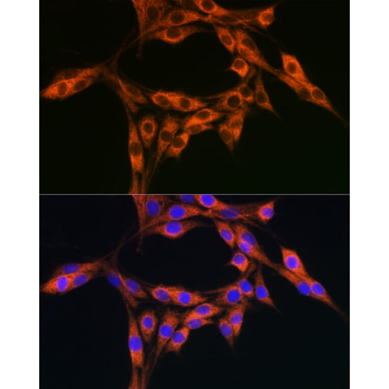 Immunofluorescence - Anti-DBI Antibody (A88009) - Antibodies.com