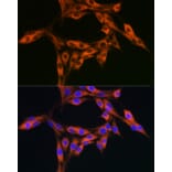 Immunofluorescence - Anti-DBI Antibody (A88009) - Antibodies.com