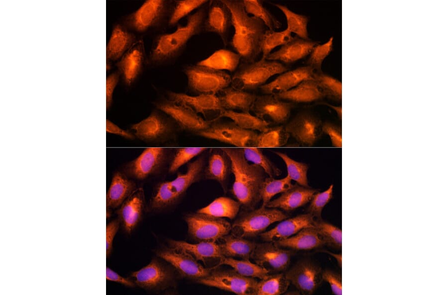 Immunofluorescence - Anti-DBI Antibody (A88009) - Antibodies.com