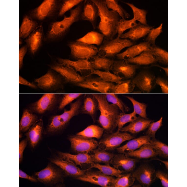 Immunofluorescence - Anti-DBI Antibody (A88009) - Antibodies.com