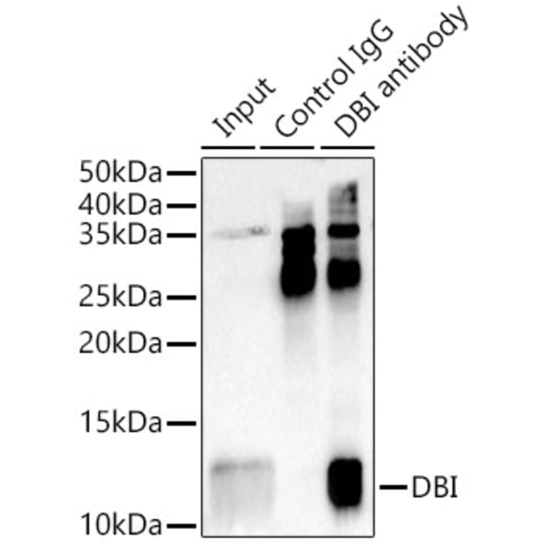 Western Blot - Anti-DBI Antibody (A88009) - Antibodies.com