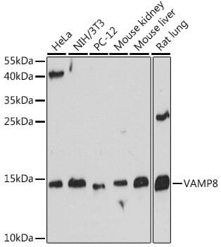 Western blot analysis of extracts of various cell lines, using Anti-VAMP8 Antibody (A13915) at 1:500 dilution.
Secondary antibody: Goat Anti-Rabbit IgG (H+L) (HRP) (AS014) at 1:10,000 dilution.
Lysates / proteins: 25µg per lane.
Blocking buffer: 3% non-fat dry milk in TBST.
Detection: ECL Basic Kit (RM00020).
Exposure time: 60s.