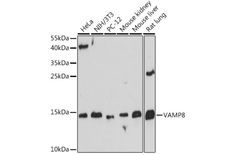 Western Blot - Anti-VAMP8/EDB Antibody (A88011) - Antibodies.com