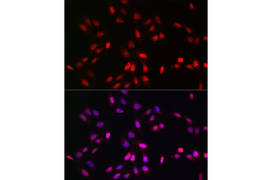 Immunofluorescence - Anti-UFM1 Antibody (A88012) - Antibodies.com