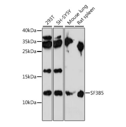 Western Blot - Anti-SF3B5 Antibody (A88013) - Antibodies.com