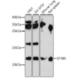 Western Blot - Anti-SF3B5 Antibody (A88013) - Antibodies.com