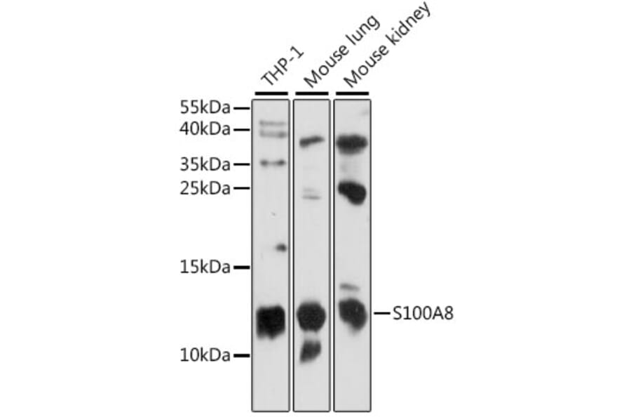 Western Blot - Anti-MRP8 Antibody (A88014) - Antibodies.com
