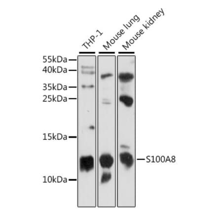 Western Blot - Anti-MRP8 Antibody (A88014) - Antibodies.com