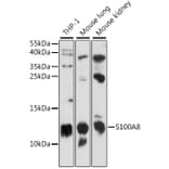 Western Blot - Anti-MRP8 Antibody (A88014) - Antibodies.com