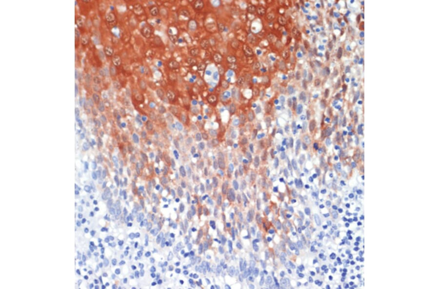 Immunohistochemistry - Anti-MRP8 Antibody (A88014) - Antibodies.com