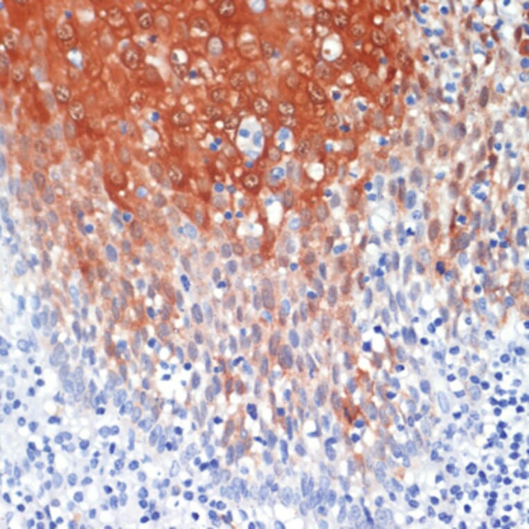 Immunohistochemistry - Anti-MRP8 Antibody (A88014) - Antibodies.com
