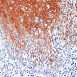 Immunohistochemistry - Anti-MRP8 Antibody (A88014) - Antibodies.com