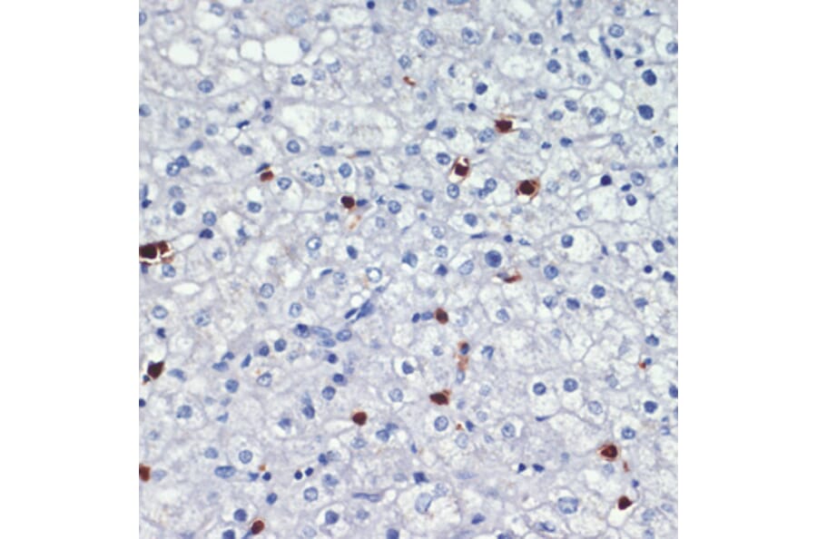 Immunohistochemistry - Anti-MRP8 Antibody (A88014) - Antibodies.com