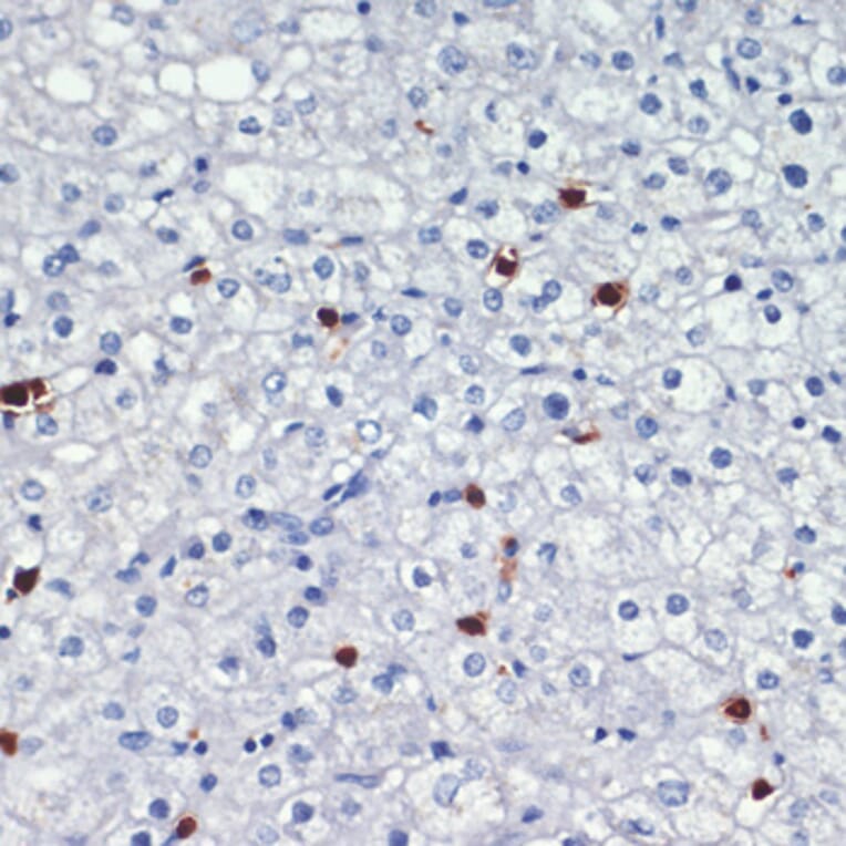 Immunohistochemistry - Anti-MRP8 Antibody (A88014) - Antibodies.com