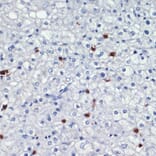 Immunohistochemistry - Anti-MRP8 Antibody (A88014) - Antibodies.com