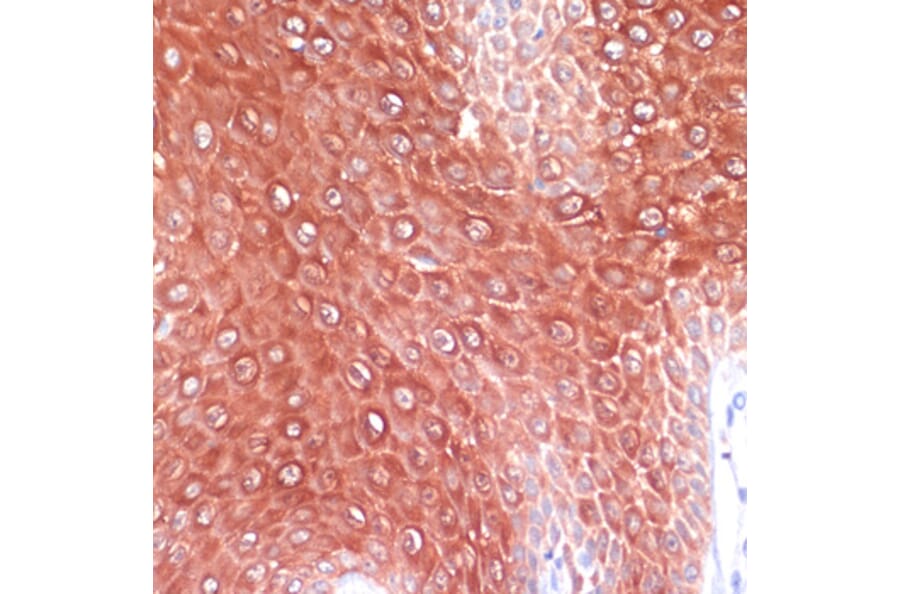 Immunohistochemistry - Anti-MRP8 Antibody (A88014) - Antibodies.com