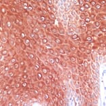 Immunohistochemistry - Anti-MRP8 Antibody (A88014) - Antibodies.com