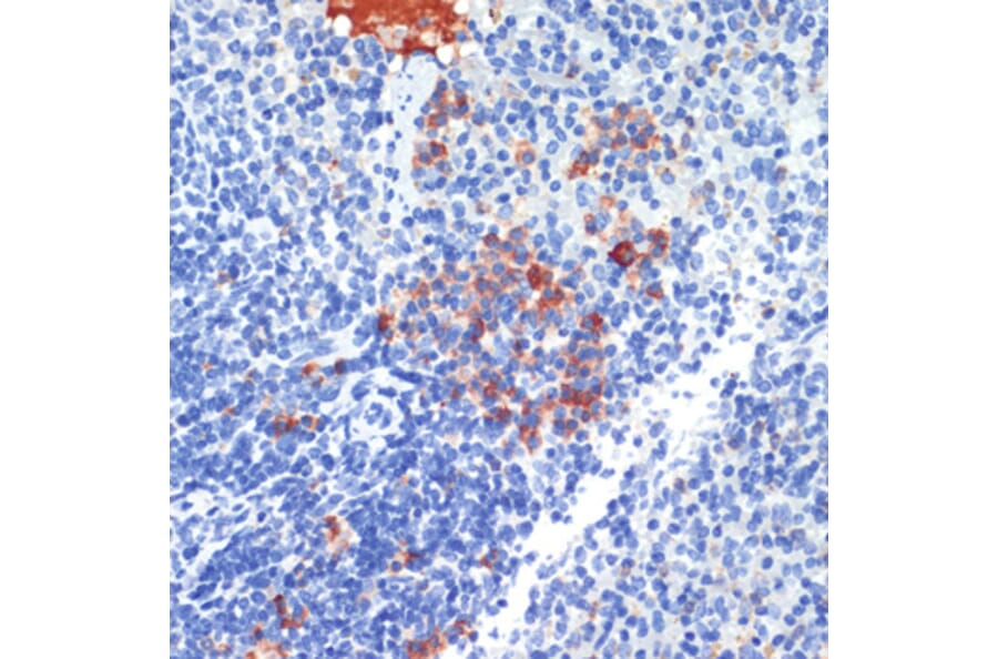 Immunohistochemistry - Anti-MRP8 Antibody (A88014) - Antibodies.com
