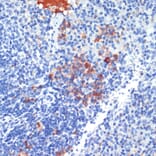Immunohistochemistry - Anti-MRP8 Antibody (A88014) - Antibodies.com