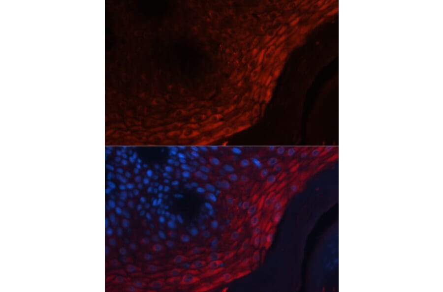 Immunofluorescence - Anti-MRP8 Antibody (A88014) - Antibodies.com