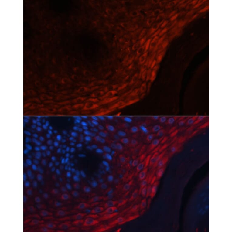 Immunofluorescence - Anti-MRP8 Antibody (A88014) - Antibodies.com