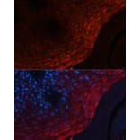 Immunofluorescence - Anti-MRP8 Antibody (A88014) - Antibodies.com