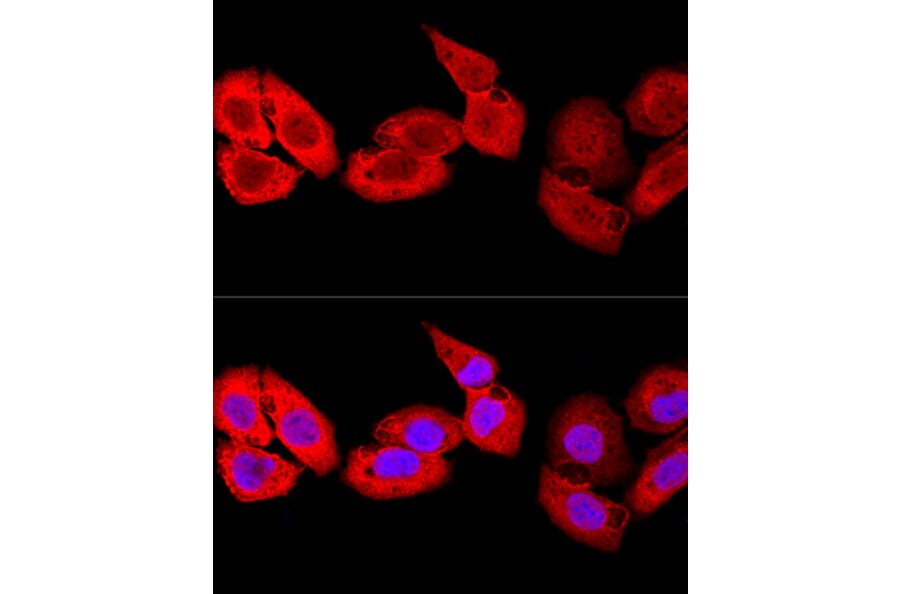 Immunofluorescence - Anti-MRP8 Antibody (A88014) - Antibodies.com