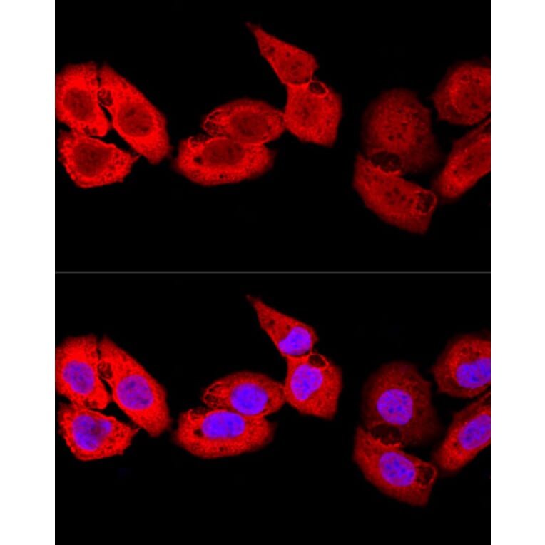 Immunofluorescence - Anti-MRP8 Antibody (A88014) - Antibodies.com
